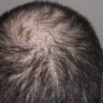 hair